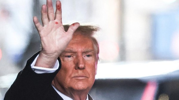 Pasca Penembakan yang Melukai Telinga Kanannya, Ini Kondisi Kesehatan Donald Trump