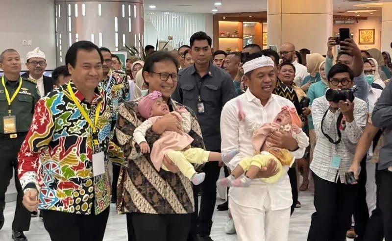Bayi Kembar Siam Dipisah, Gubernur Jabar Apresiasi