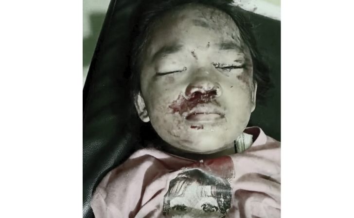 Bocah SD di Pekanbaru Kritis Diserang Gajah Sumatera