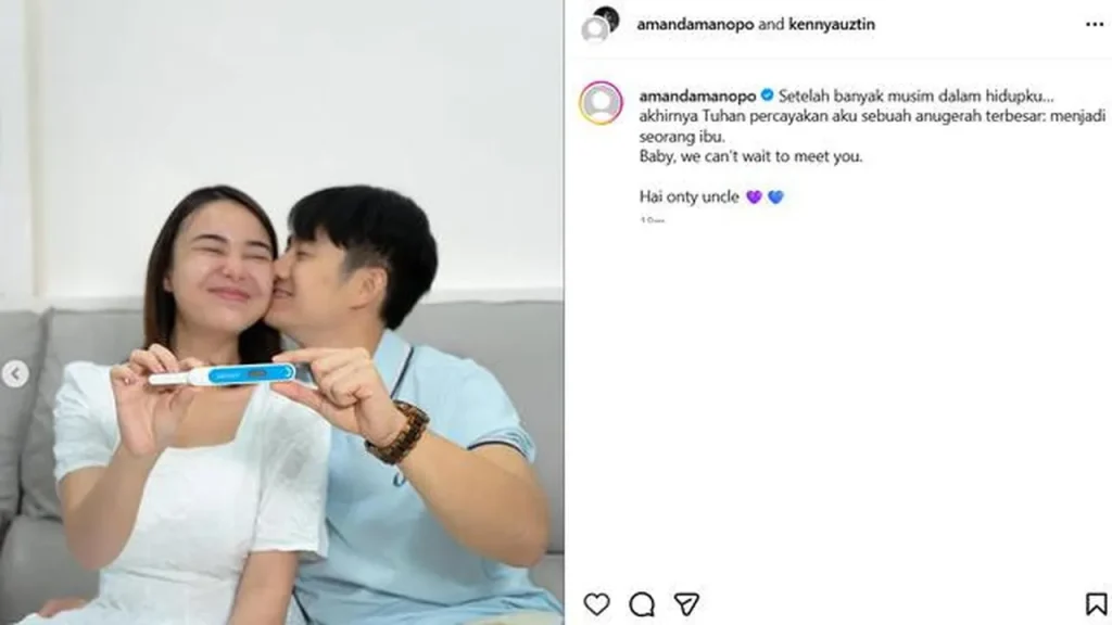 Bagikan Kabar Gembira, Amanda Manopo Akhirnya Mengumumkan Kehamilan kepada Publik