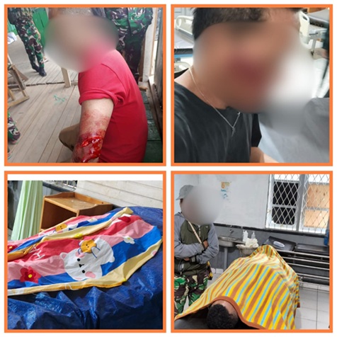 Empat Warga Deiyai Dibacok OTK, Dua Orang Meninggal Dunia