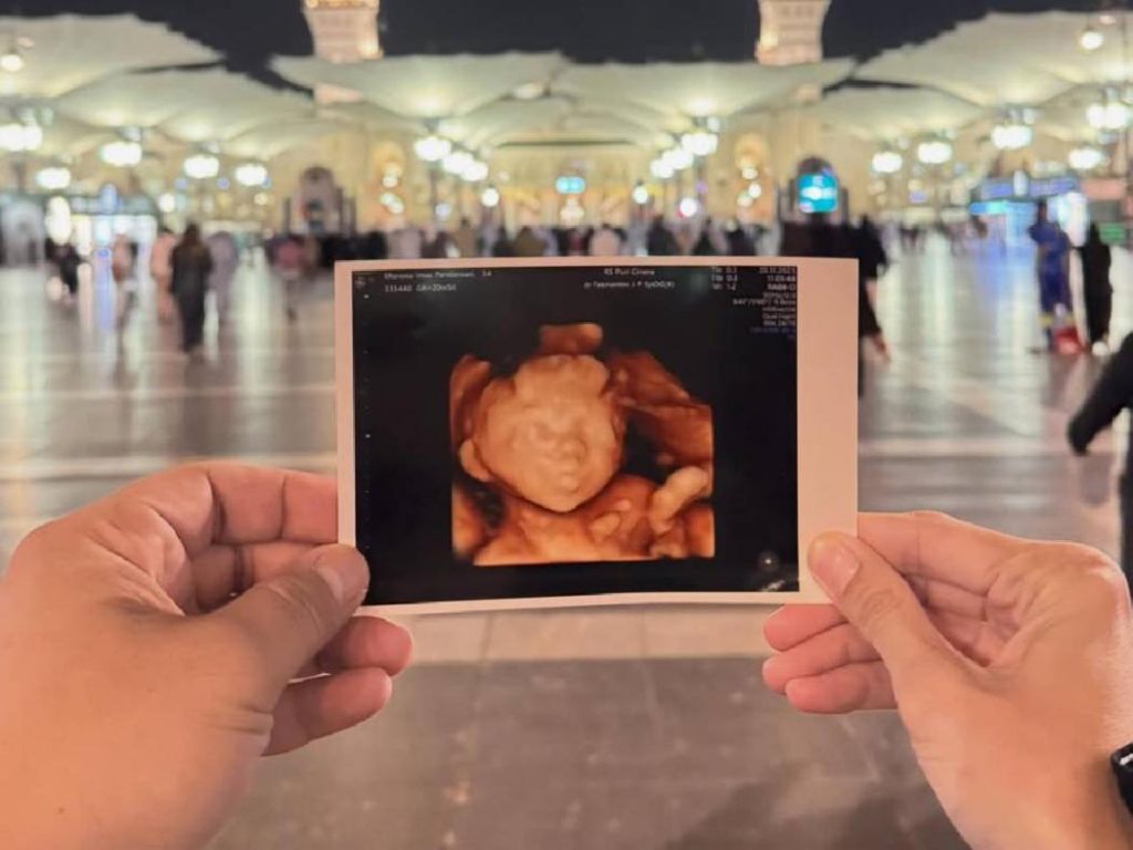 Anak Keempat Rizal Armada Meninggal Dunia di Usia Kandungan 7 Bulan