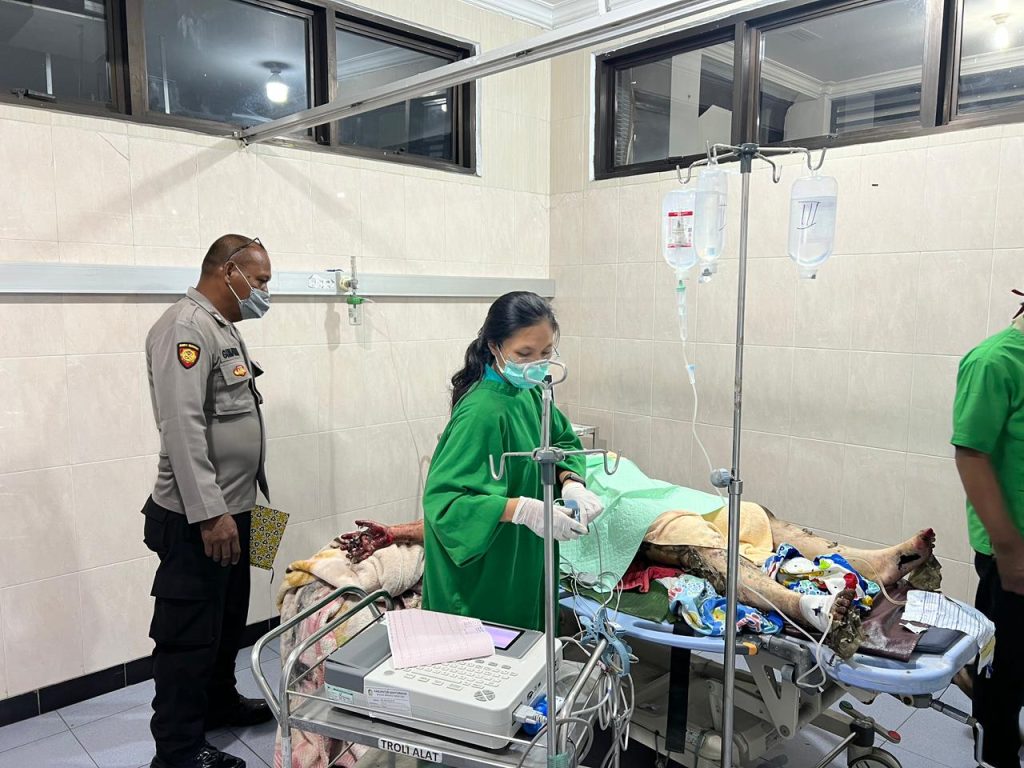 Tragis! Istri Dibakar Suami di Banyuwangi, Keduanya Kritis