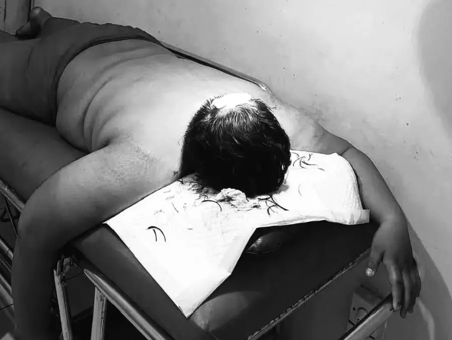 Dugaan Pengeroyokan di Lontar Surabaya, Korban Tunggu Perkembangan Kasus